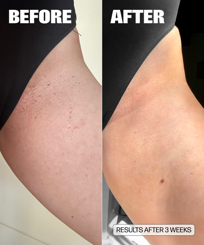 Side-by-side comparison of a person’s upper thigh. Left: red bumps and irritation labeled Before. Right: smoother, clearer skin labeled After and captioned “Results after 3 weeks with Wholesale VMAGIC® Grooming Polish.”.